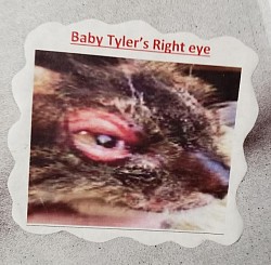 Baby Tyler's right eye